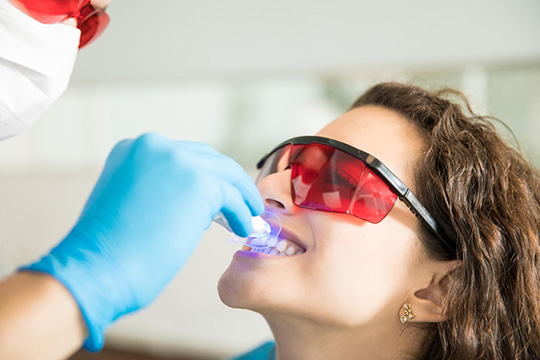 Blanqueamiento Dental